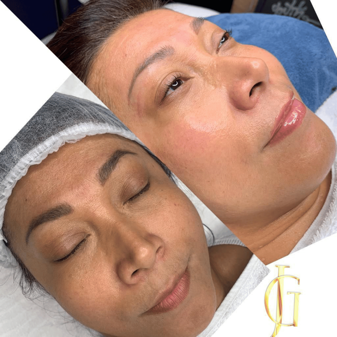 Deep facial cleansing treatment